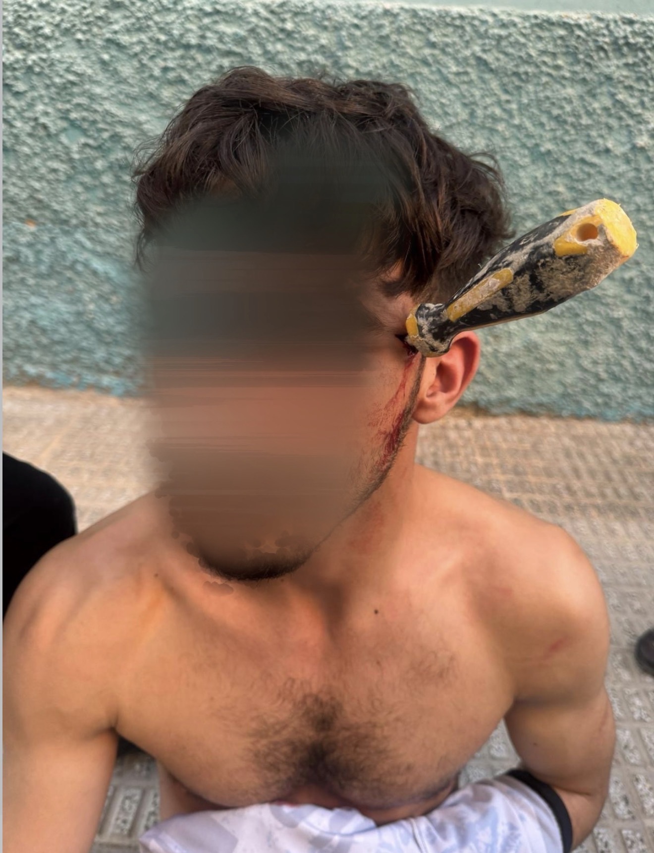 Un hombre herido con un destornillador clavado en la cabeza tras una violenta reyerta en Albatera