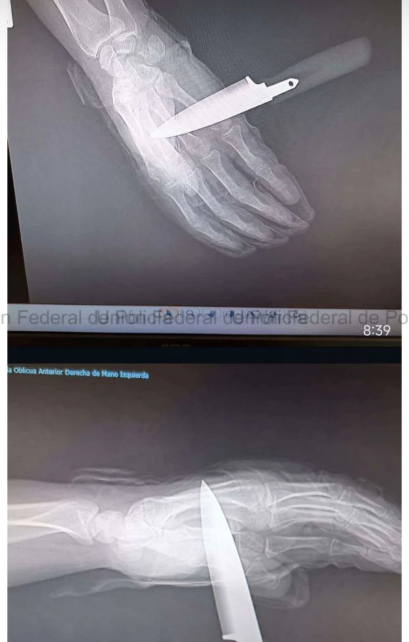 Apuñalan a un policía nacional en Baza durante una intervención por una discusión familiar